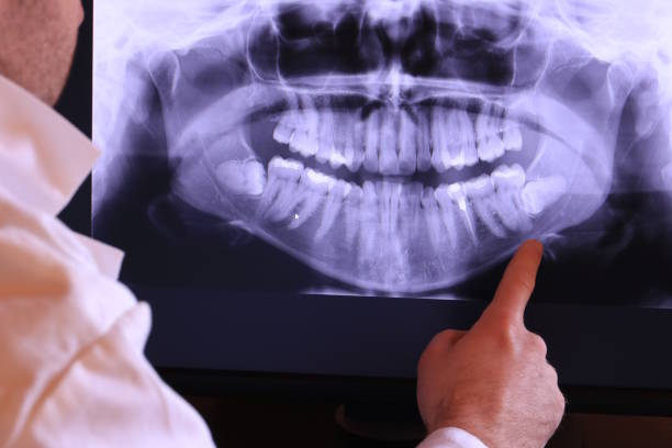 Best Emergency Root Canal Treatment in Liberal, KS